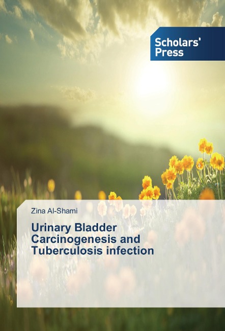 Urinary Bladder Carcinogenesis and Tuberculosis infection