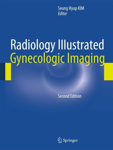 Radiology Illustrated: Gynecologic Imaging