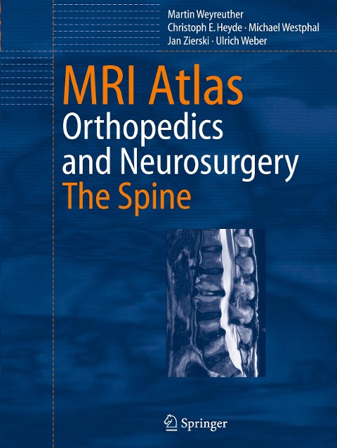 MRI Atlas: Orthopedics and Neurosurgery, The Spine