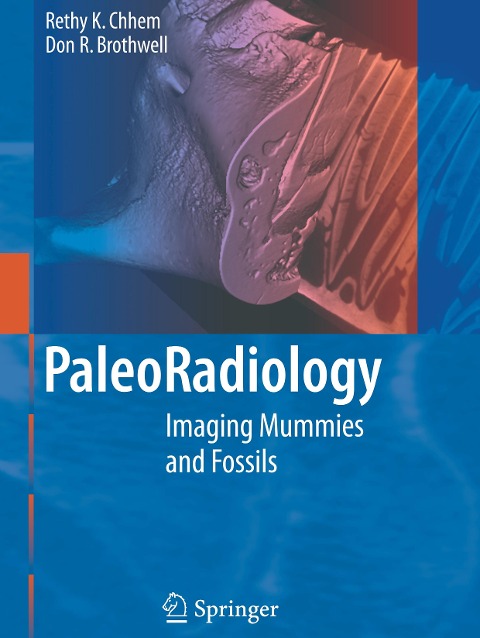 Paleoradiology: Imaging Mummies and Fossils