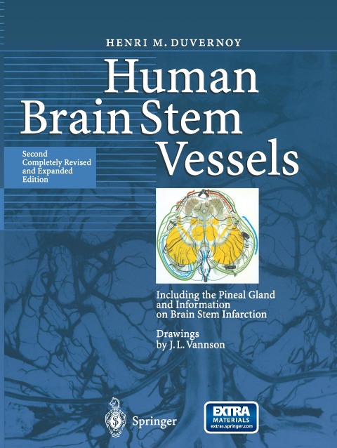 Human Brain Stem Vessels: Including the Pineal Gland and Information on Brain Stem Infarction
