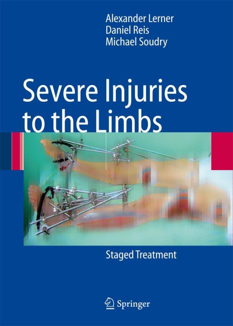 Severe Injuries to the Limbs: Staged Treatment