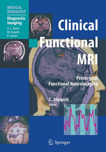 Clinical Functional MRI Presurgical Functional Neuroimaging