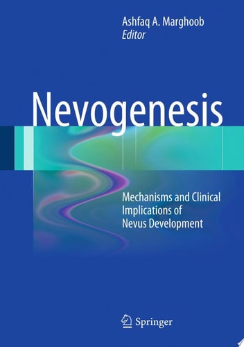 Nevogenesis Mechanisms and Clinical Implications of Nevus Development