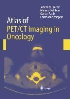 Atlas of PET/CT Imaging in Oncology