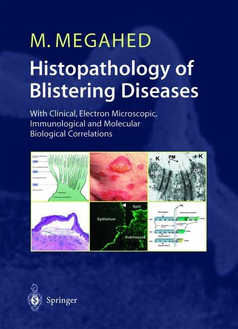 Histopathology of Blistering Diseases: With Clinical, Electron Microscopic, Immunological and Molecular Biological Correlations Textbook and Atlas