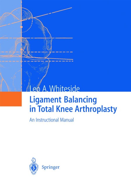Ligament Balancing in Total Knee Arthroplasty: An Instructional Manual
