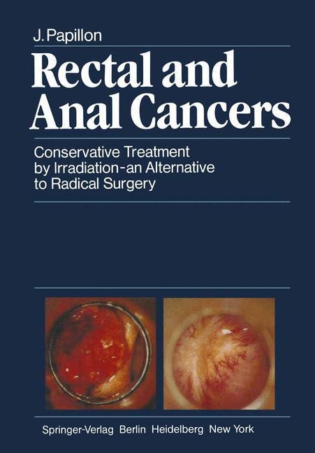 Rectal and Anal Cancers: Conservative Treatment by Irradiation - an Alternative to Radical Surgery