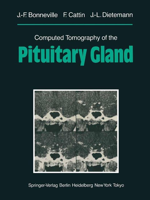 Computed Tomography of the Pituitary Gland: With a Chapter on Magnetic Resonance Imaging of the Sellar and Juxtasellar Region, By M. Mu Huo Teng and K. Sartor