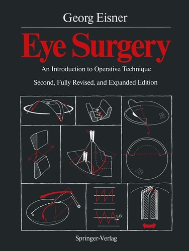 Eye Surgery An Introduction to Operative Technique