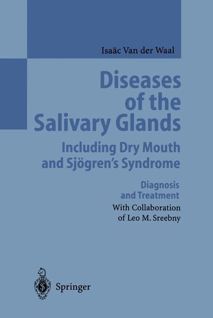 Diseases of the Salivary Glands Including Dry Mouth and Sjögrens Syndrome: Diagnosis and Treatment
