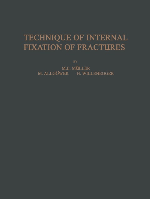 Technique of Internal Fixation of Fractures