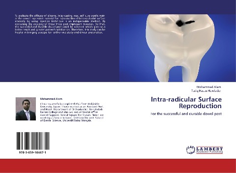 Intra-radicular Surface Reproduction: For the successful and durable dowel post