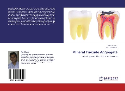 Mineral Trioxide Aggregate: The basic guide of its clinical applications
