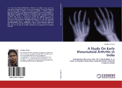 A Study On Early Rheumatoid Arthritis In India: Comparison Between DAS-28, CDAI & HAQ-DI as Tools to Monitor Early Rheumatoid Arthritis Patients in Eastern India