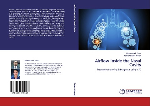 Airflow Inside the Nasal Cavity: Treatment Planning & Diagnosis using CFD