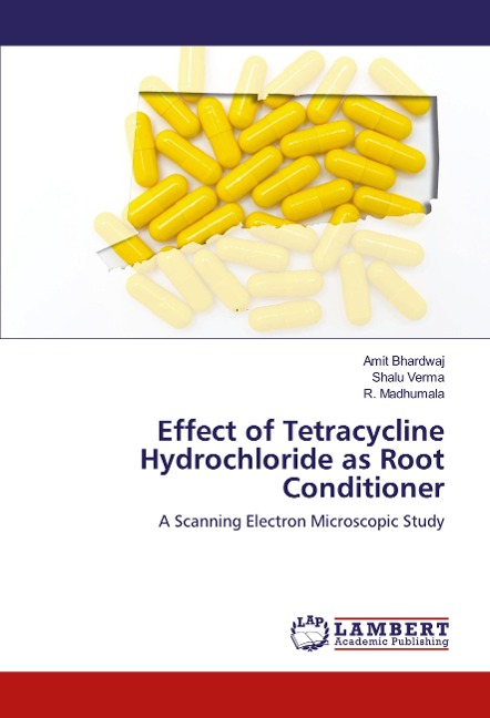 Effect of Tetracycline Hydrochloride as Root Conditioner: A Scanning Electron Microscopic Study