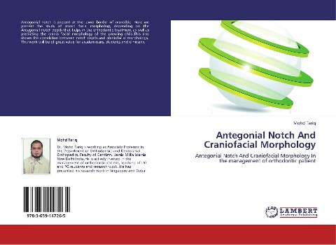 Antegonial Notch And Craniofacial Morphology: Antegonial Notch And Craniofacial Morphology In the management of orthodontic patient