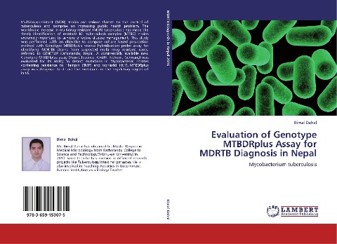 Evaluation of Genotype MTBDRplus Assay for MDRTB Diagnosis in Nepal: Mycobacterium tuberculosis