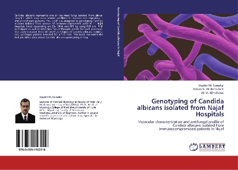 Genotyping of Candida albicans isolated from Najaf Hospitals: Molecular characterization and antifungal profile  of Candida albicans isolated from immunocompromised patients in Najaf