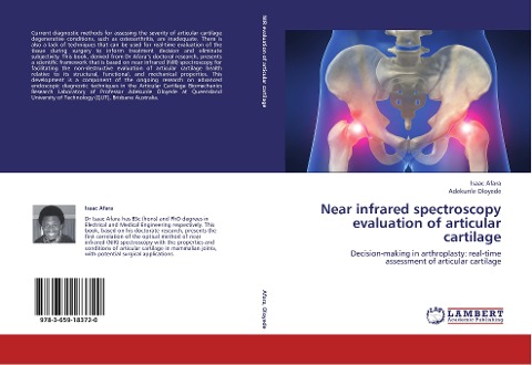 Near infrared spectroscopy evaluation of articular cartilage: Decision-making in arthroplasty: real-time assessment of articular cartilage