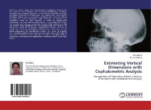 Estimating Vertical Dimensions  with Cephalometric Analysis: Management of Edentulous Patients Vertical dimensions with Cephalometric Analysis