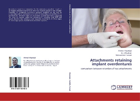 Attachments retaining implant overdentures: comparison between retention of  two attachments