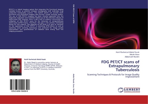 FDG PET/CT scans of Extrapulmonary Tuberculosis: Scanning Techniques & Protocols for Image Quality Improvement