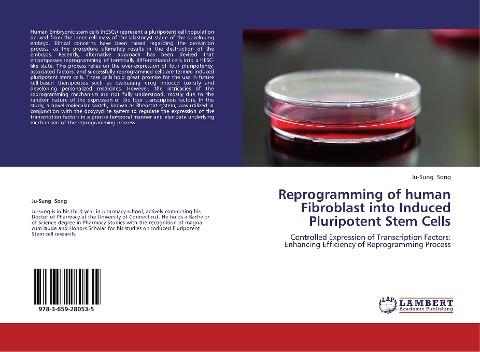 Reprogramming of human Fibroblast into Induced Pluripotent Stem Cells: Controlled Expression of Transcription Factors: Enhancing Efficiency of Reprogramming Process