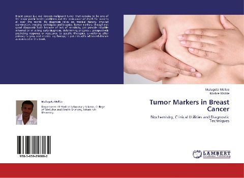 Tumor Markers in Breast Cancer: Biochemistry, Clinical Utilities and Diagnostic Techniques