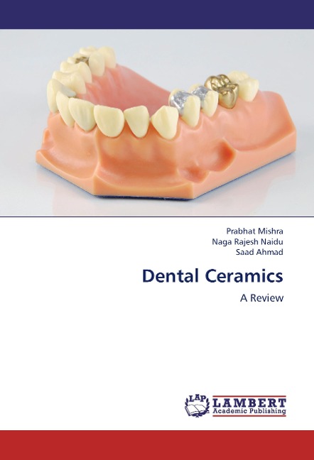 Dental Ceramics: A Review