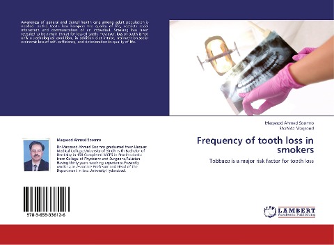 Frequency of tooth loss in smokers: Tobbaco is a  major risk factor for tooth  loss