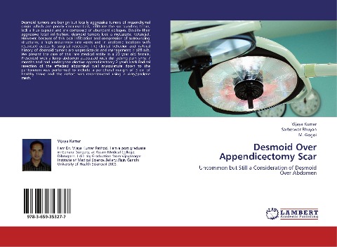 Desmoid Over Appendicectomy Scar: Uncommon but Still a Consideration of Desmoid Over Abdomen
