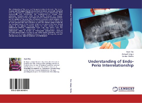 Understanding of Endo-Perio Interrelationship