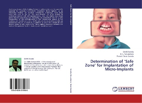 Determination of Safe Zone for Implantation of Micro-Implants