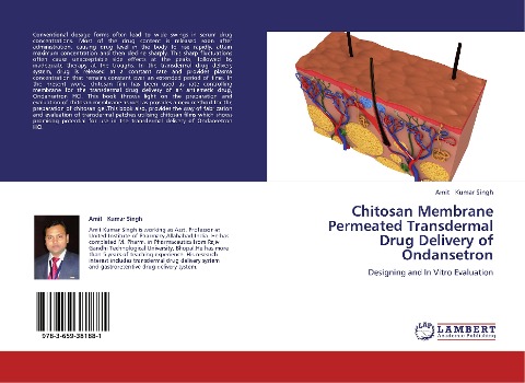 Chitosan Membrane Permeated Transdermal Drug Delivery of Ondansetron: Designing and In Vitro Evaluation
