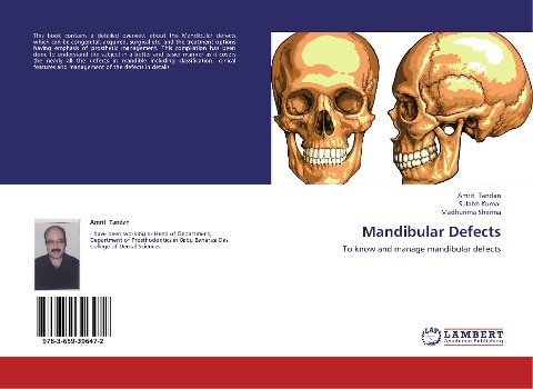Mandibular Defects: To know and manage mandibular defects