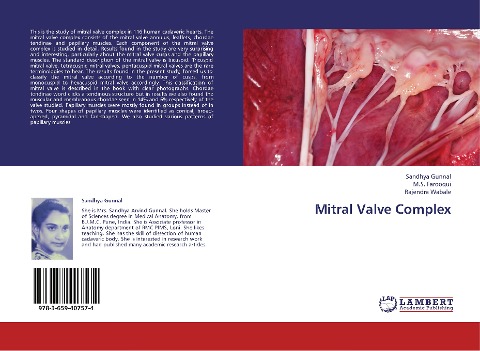 Mitral Valve Complex