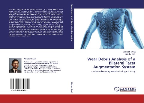 Wear Debris Analysis of a Bilateral Facet Augmentation System: In-vitro Laboratory Based Tribological Study