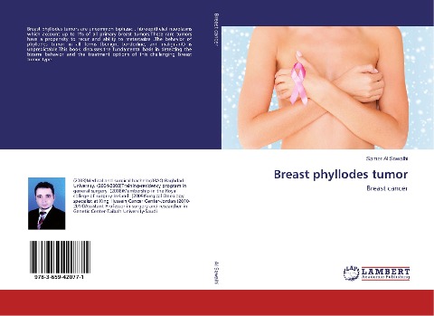 Breast phyllodes tumor: Breast cancer