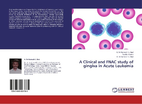 A Clinical and FNAC study of gingiva in Acute Leukemia