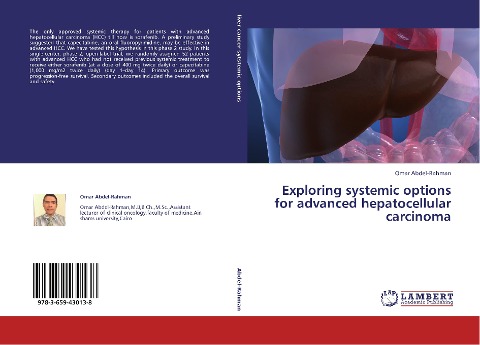 Exploring systemic options for advanced hepatocellular carcinoma