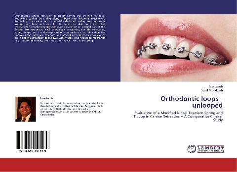 Orthodontic loops - unlooped: Evaluation of a Modified Nickel Titanium Spring and T Loop in Canine Retraction - A Comparative Clinical Study