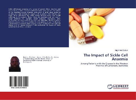 The Impact of Sickle Cell Anaemia: Among Patients with the Disease in the Western Province of Cameroon, Bamenda