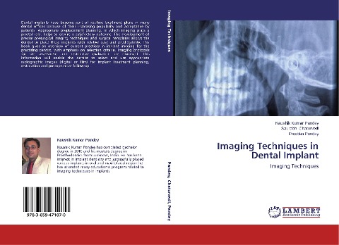 Imaging Techniques in Dental Implant: Imaging Techniques