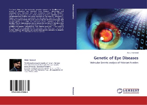 Genetic of Eye Diseases: Molecular Genetic analysis of Pakistani Families