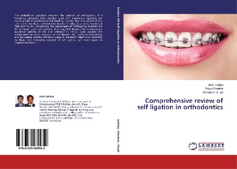 Comprehensive review of self ligation in orthodontics