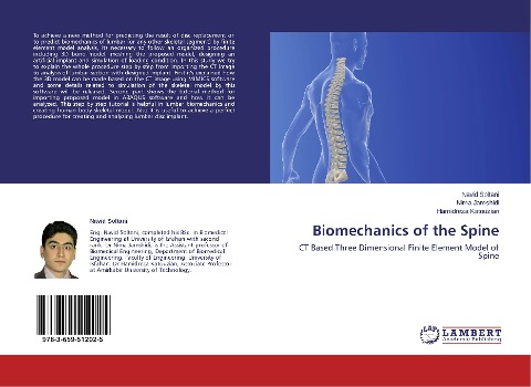 Biomechanics of the Spine: CT Based Three Dimensional Finite Element Model of Spine