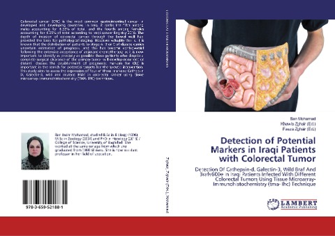 Detection of Potential Markers in Iraqi Patients with Colorectal Tumor: Detection Of Cathepsin-d, Galectin-3, Wild Braf And Brafv600e In Iraqi Patients Infected With Different Colorectal Tumors Using Tissue Microarray- Immunohistochemistry (tma- Ihc) Tech