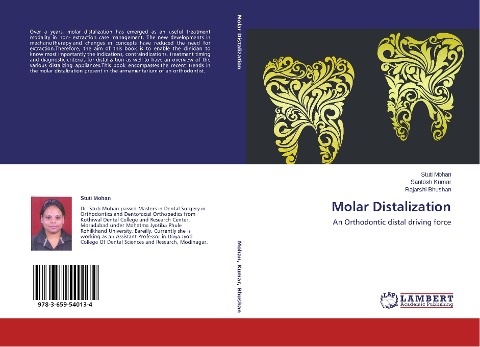 Molar Distalization: An Orthodontic distal driving force
